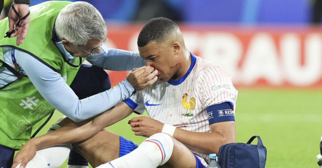 Deschamps: Mbappe’nin Burnu Kırıldı!