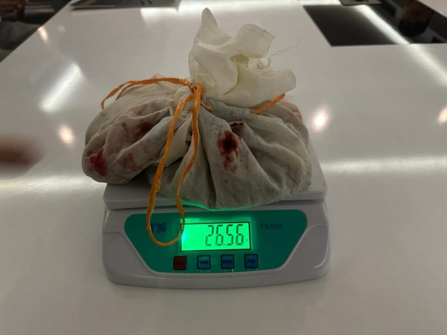 İstanbul’da 100.000 Adet Kaçak Tıbbi Sülük Ele Geçirildi