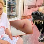 HATAY’DA KÖPEK DEHŞETİ: MARKETE GİTMEK İSTERKEN HASTANELİK OLDU