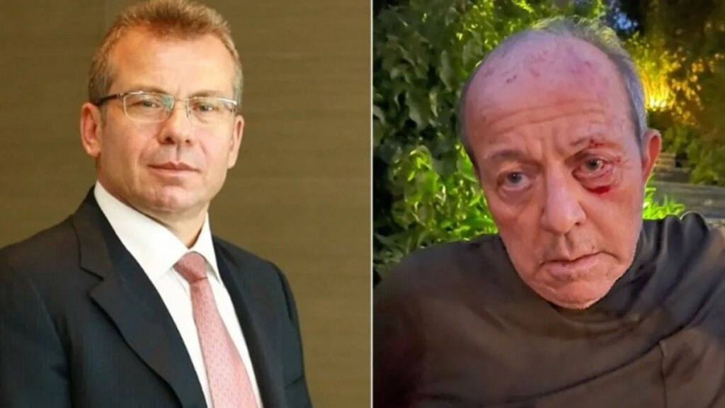 Kaya Sabancı’nın Elmacık Kemiğinde Kırık Var, Ameliyat Olacak