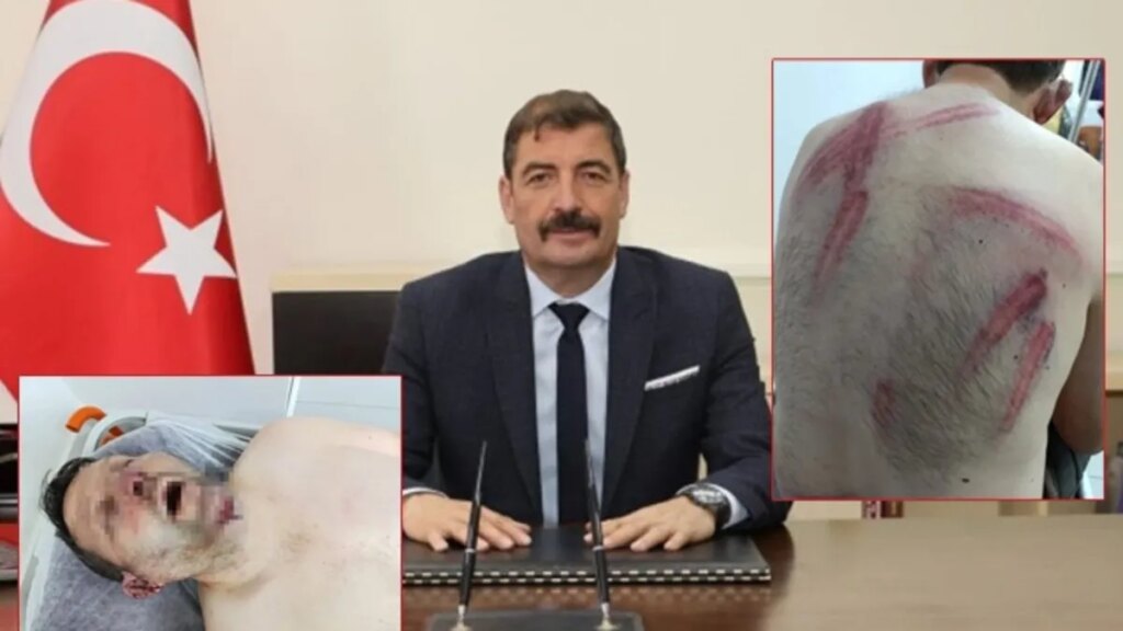 CHP’li Belediye Başkanı Darp Skandalı!