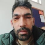 Veteriner Hekim Darp Edildi, Meslektaşlarına Destek Çağrısı!