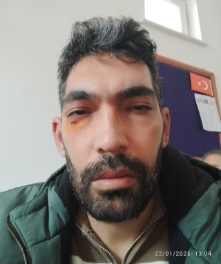 Veteriner Hekim Darp Edildi, Meslektaşlarına Destek Çağrısı!