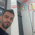 Mehmet Gündoğan’ın ölümü sarı serumdan mı kaynaklandı?