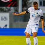 Dzeko’nun Burnu Kırıldı!